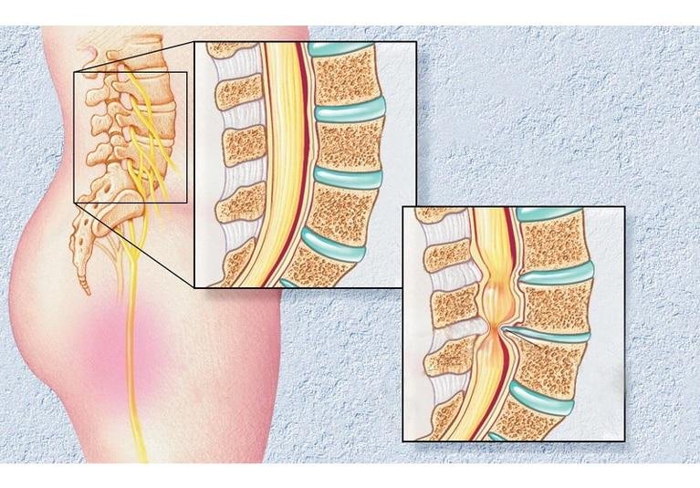 What happens during forward bending